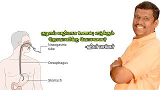 குழாய் வழியாக உணவு எடுக்கும் நோயாளிக்கு யோசனை? HEALER BASKAR