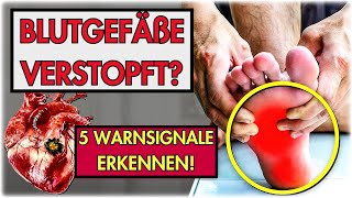 5 WARNZEICHEN, dass Ihre GEFÄẞE VERSTOPFT sind – IGNORIEREN Sie diese SYMPTOME NICHT!