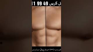 Jism Pe til Ka Hona | Meaning Of till on Human Body | Til Definition | Mehrban Ali | Mehrban TV