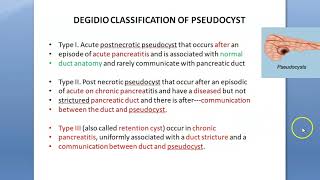 Surgery 615 PseudoCyst Of Pancreas type Degidio treatment pancreatitis engine oil Baid sign