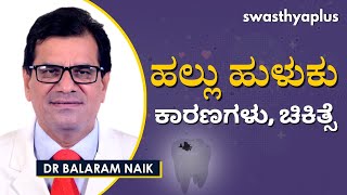 ಹಲ್ಲು ಹುಳುಕು : ಕಾರಣಗಳು ಮತ್ತು ಚಿಕಿತ್ಸೆ | Dr Balaram Naik on Dental Cavities in Kannada