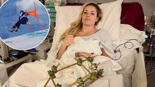 Lindsey Vonn Fires Back at Retirement Talk After Dad’s Plea Following Horrific Olympic Injury