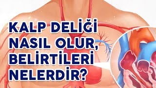 Kalp Deliği Nasıl Olur ve Belirtileri Nelerdir? #anomali #tedavi #sağlık