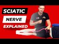 What is Sciatica and What Causes it? Sciatica Explained by a Physiotherapist.