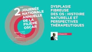 Histoire naturelle Dysplasie fibreuse des os (Avr. 2016)