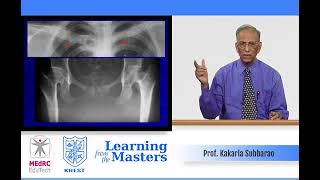 Practical Approach to Skeletal Dyspasia 01 - Prof Kakarla Subba Rao