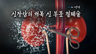 [명의 의학백과📖] 신장암의 개복 신 부분 절제술