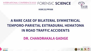 A rare case of bilateral symmetrical temporo-parietal extradural hematoma | Dr. Chandrakala Gadige