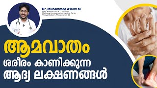 ആമവാതം ശരീരം കാണിക്കുന്ന ആദ്യ ലക്ഷണങ്ങൾ | Rheumatoid Arthritis Malayalam | Dr. Muhammed Aslam