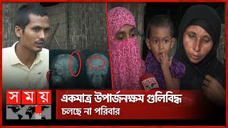 মাথার ভেতরে বুলেট, অপারেশনের সামর্থ্য নেই | Kurigram News | Anti-Discrimination Movement | Somoy TV