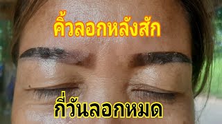 คิ้วลอกหลังสักกี่วันหมด?/ Eyebrows tattoo how to aftercare