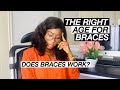 Process of getting Braces | Before putting on Braces | 4 Things to know | Before getting braces