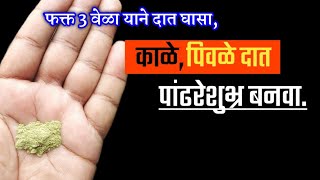 फक्त 3 वेळा याने दात घासा, काळे पिवळे दात पांढरेशुभ्र बनवा। मोत्यासारखे पांढरे दात; swagat todkar