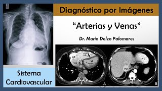 Arterias y Venas