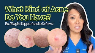 What Kind of Acne Do You Have? Dr. Pimple Popper Breaks It Down I SLMD Skincare