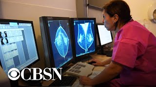 The importance of scheduling mammograms, even amid the pandemic