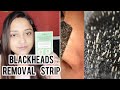 BLACKHEAD REMOVAL!! Pore Nose Charcoal Strip Honest Review || #youtube MONALISA BONG GIRL