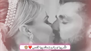 اشريها لو بالروح وافديها نفسي⁦❤️⁩✨دكيت انا البيبان ماصح مثلها/حالات واتساب للعشاق