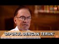 Anwar imbau insiden mata lebam: ‘Saya ingat tak hidup lagi’