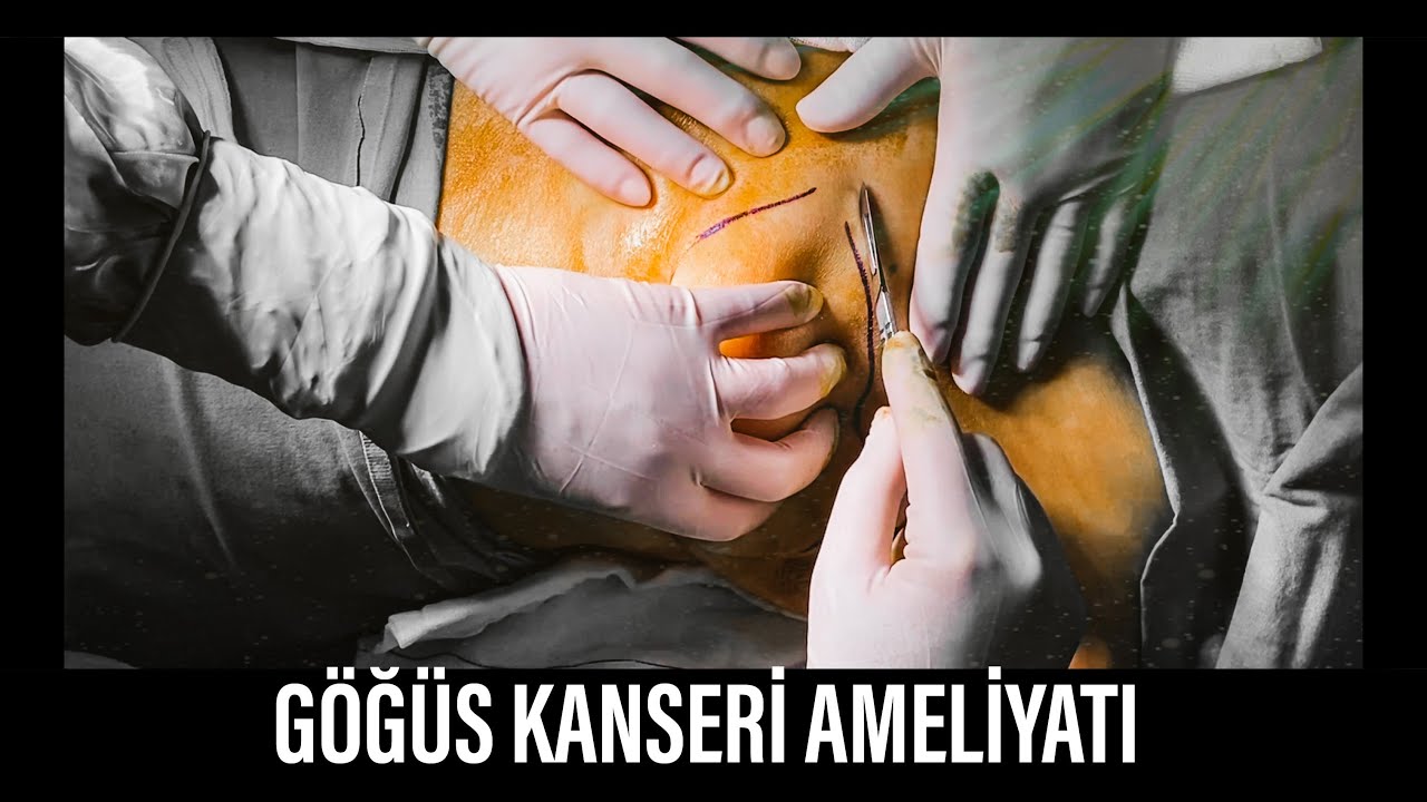 MEME KANSERİ AMELİYATI, TÜM SÜREÇ, AMELİYAT HEMŞİREM DE KANSERİ YENMİŞ ...