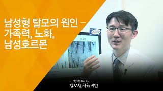 남성형 탈모의 원인 – 가족력, 노화, 남성호르몬 - (20180801_657회 방송) 毛자람에 대하여