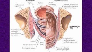 Biomechanics of Childbirth: Insights into Pelvic Floor Disorders - 1