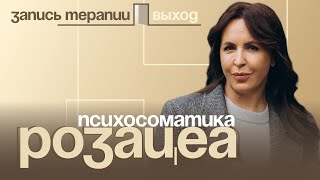 Психосоматика розацеа | Выход с Ольгой Дивеевой