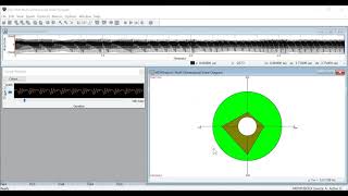 Visi-Pitch, Model 3950c: Multi-Dimensional Voice Program (MDVP) Tutorial