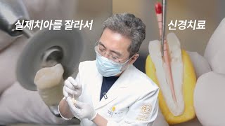 유튜브 최초(?) 실제 치아 반으로 쪼개서 신경치료하기