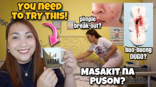 Effective PAMPALABAS NG BUO-BUONG DUGO \u0026 IWAS PIMPLE BREAKOUT | MY DYSMENORRHEA SOLUTION ayaesguerra