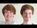 We're Identical Twins - But Only On One Side | BORN DIFFERENT