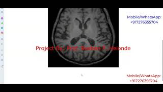 Types Of Brain Tumor Detection Using Image Processing Python Project With Source Code