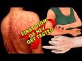 What Is Usually The First Sign Of HIV?