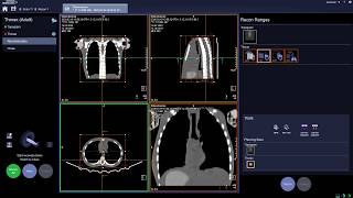 CT SOMATOM go.Up Thorax k-    Grensesnitt og radiografens arbeidsflyt.