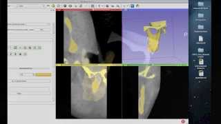 Tutorial: Preparing Data for 3D Printing Using 3D Slicer Tutorial: Preparing Data for 3D Printing Using 3D Slicer