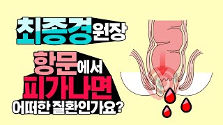 수원치질)항문에서 피가나면 어떤 질환인가요? 무서워요...