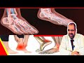 أسرع علاج للألم: التهابات الأعصاب والقدمين والأملاح والضعف العام / دكتور جودة محمد عواد