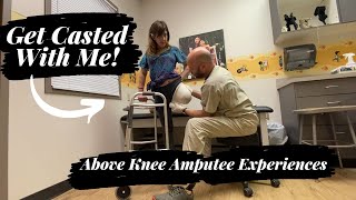Above Knee Amputee Getting Casted for a Prosthetic Socket After Revision