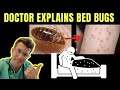 Doctor explains BED BUGS - including SYMPTOMS, TREATMENT AND PREVENTION ( +PHOTOS!)