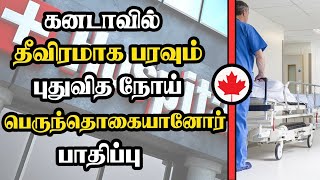 கனடாவில் தீவிரமாக பரவும் புதுவித நோய் - பெருந்தொகையானோர் பாதிப்பு