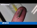 Man implants Tesla key into skin to unlock car by raising hand