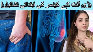 6 Early signs of COLON CANCER | بڑی آنت کے کینسر کی ابتدائی علامات | Dr. Bushra