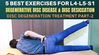 5 Exercises- Lumbar Disc Degeneration, Disc Desiccation, Degenerative Disc Disease Treatment- Part 2