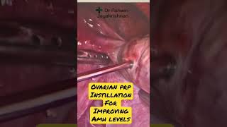 Ovarian PRP for increasing AMH levels | Dr Ashwin | Malayalam video |