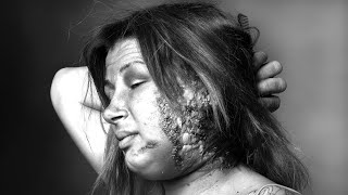 Bubonic Plague On Skid Row Princess 2025 Update