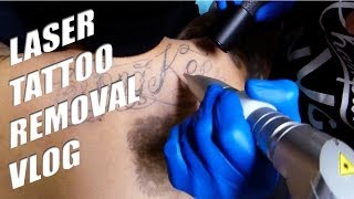 NEW LASER TATTOO REMOVAL VLOG | MJ DRIVER LASER