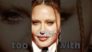 Botched Face Filler Surgeries Celebrities Regret #9