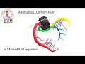 Anomalous LCX from RCA with retroaortic course, Dr Alaa Nasr