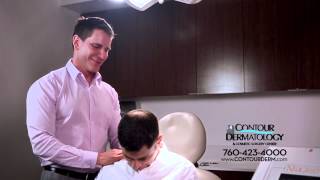 NeoGraft FUE Hair Transplant, No Scar, No Downtime