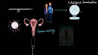 Artificial insemination and GIFT | Reproductive health | Biology | Khan Academy